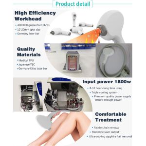 2018 hottest Beijing Nubway effective 2000W high power skin tightening 808nm