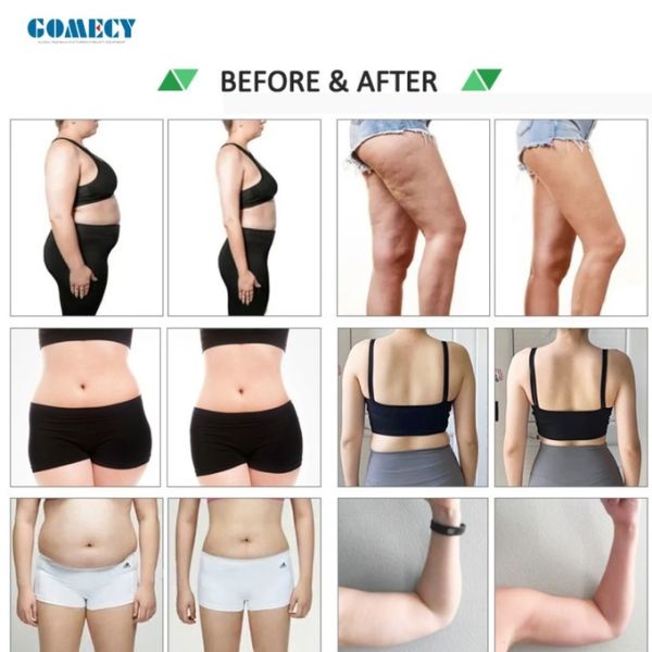 CE 10 Green Luxmaster Slim Lipo Laser Therapy Machine For Full Body Arms Back Fat Reduction