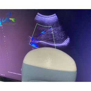 GE RM6C 4d Probe Repair Motor Control Failures