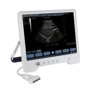 TS20 Digital Diagnostic Ultrasound System for Obstetrics and Gynecology