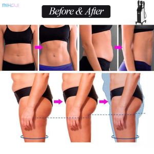 Easy Operation 5 Handles peface Neo Machine For Body Sculpting And Muscle