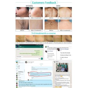 2018 hottest Beijing Nubway effective 2000W high power skin tightening 808nm