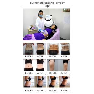 DM-55 Portable RF Cryolipolysis Slimming Machine 350mW pulse Fat Freezing