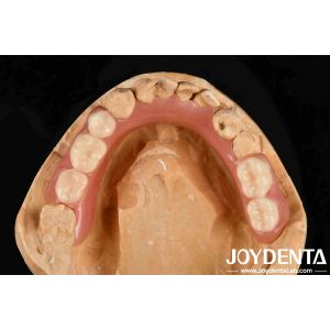 China Personalized Customization Acrylic Denture Finish Good Elasticity And Lightweight Property For Enhanced Prosthetic Performance on sale