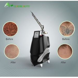 Quality Tattoo removal birthmark removal 1064/532nm laser Picosecond laser machine for sale