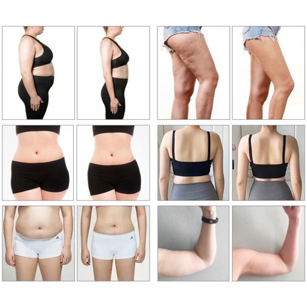 532nm 635nm Cold Laser Weight Loss Machine 10d Maxlipo Master