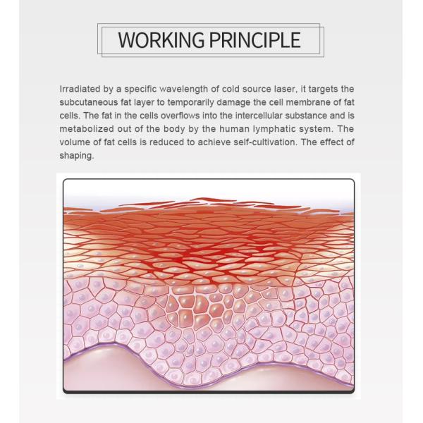 Fat Removal Non Invasive 8D Laser Therapy Machine Dual Wavelength 532nm 635nm Red And Green Light