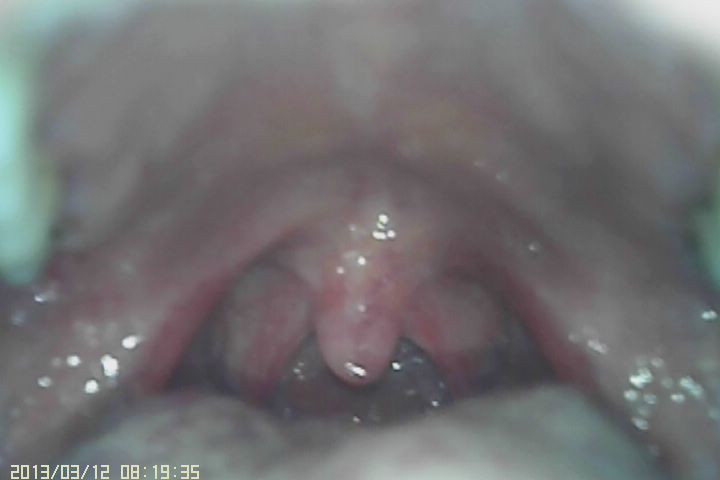 3.5 Inch LCD Monitor Handheld Otoscope Opthalmoscope Diagnostic Video Camera Laryngoscope With CE Certificate