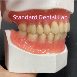 Full Upper And Lower Stayplate Acrylic Partial Dentures Ivoclar Teeth Pink Gum