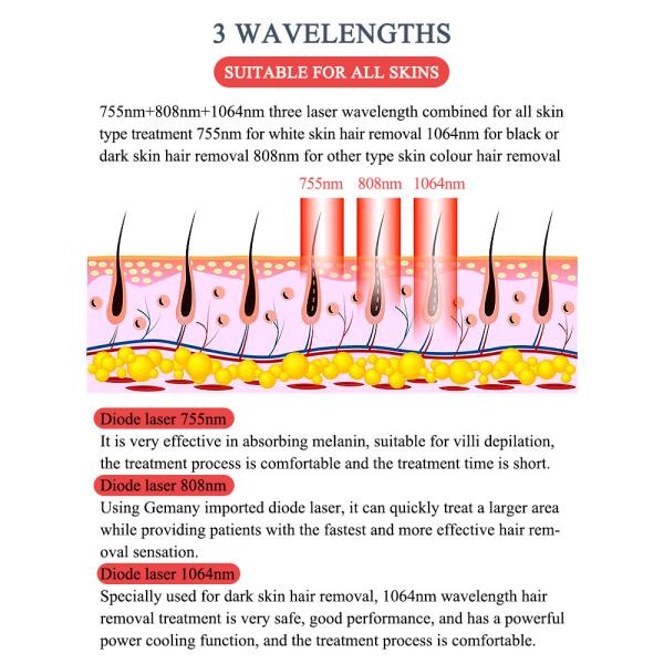 Triple Wavelength Laser Hair Removal With Skin Type Recognition And Cooling Fans