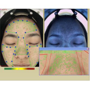 Professional 3d Facial Skin Hydration Analyzer Machine With Touch Screen
