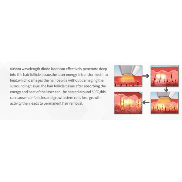 755 808 1064nm Triple Laser Hair Removal Machine 2 Handles Diodo Pico Second Yag Tattoo