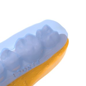 Transparent Jaw Pad Thermotropic Resin