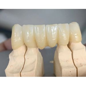 98mm 3D Plus Multilayer Dental Zirconia Blocks YUCERA the Best Dental Zirconia