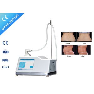 Effective HIFU Skin Tightening Machine Liposuction 620 shots cartridge