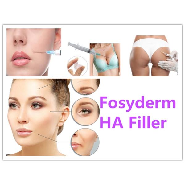 Medical 2ml Hyaluronic Acid Dermal Filler For Lips Chin Nose Lidocaine