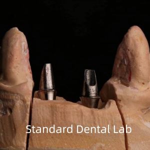 China Dental Porcelain Zirconia Implant Crown Professional High Esthetics on sale