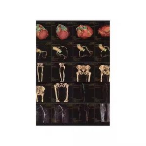 Medical X Ray Film Dry Thermal For Printer