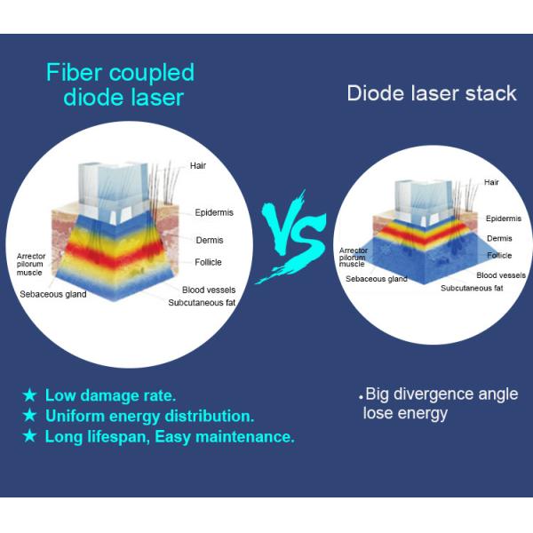 755nm 808nm 1064nm Fiber Coupled Diode Laser Hair Removal Machine