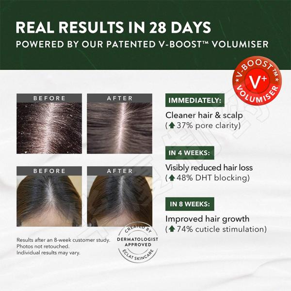 Private Label Hair Growth Shampoo For Women Men