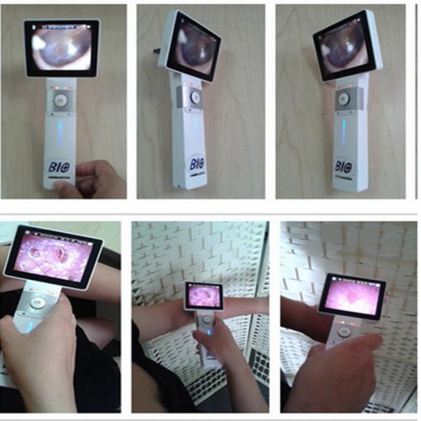 ProfessionalENT Endoscope Ear Camera Digital Video Otoscope With Rechargeable Lithium Battery