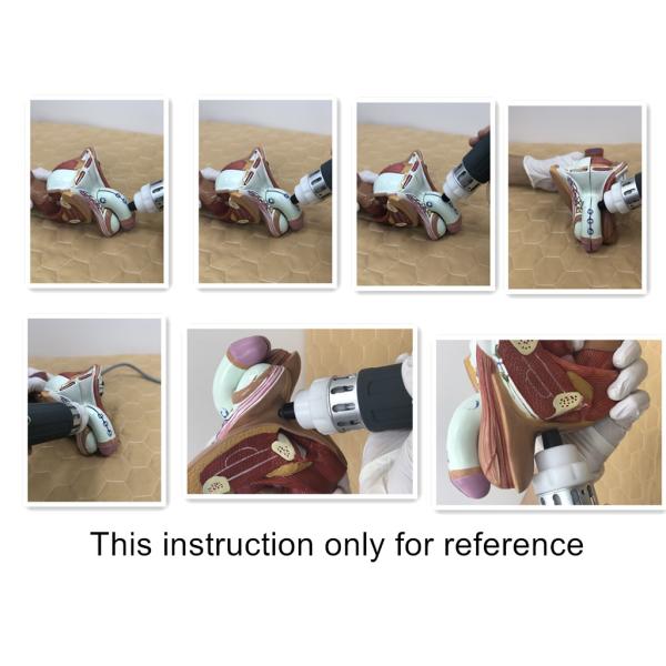 Lightweight Electromagnetic Therapy Machine For Erectile Dysfunction Treatment