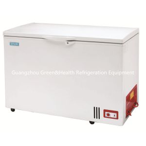 340L Large Home Chest Freezers Luxurious Appearance Hard Top