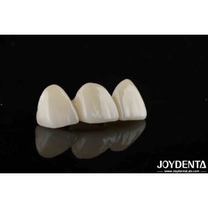 Natural-looking Style With Layers Full Zirconia High Translucency And Aesthetics