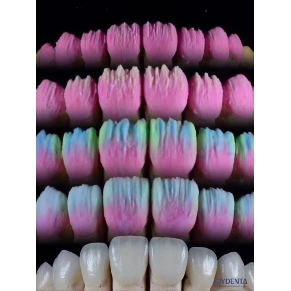Buy The Joydenta Ceramic Veneer Process at wholesale prices