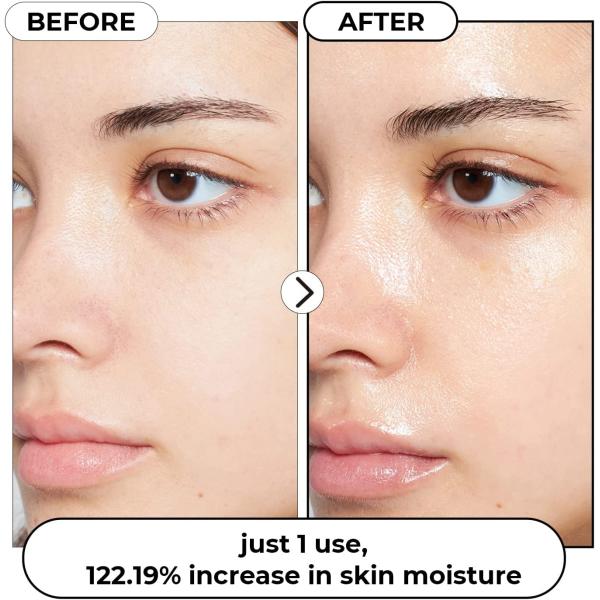 Hyaluronic Toner Rice Water Rose Moisture Tonic Oil Control Hydrating Facial Toner