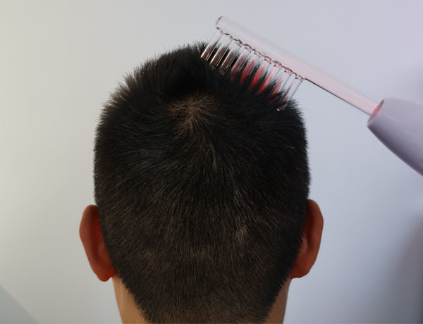 Multifunctional Hair Therapy Scalp Caring Machine For Custom Logo And Scalp Repair