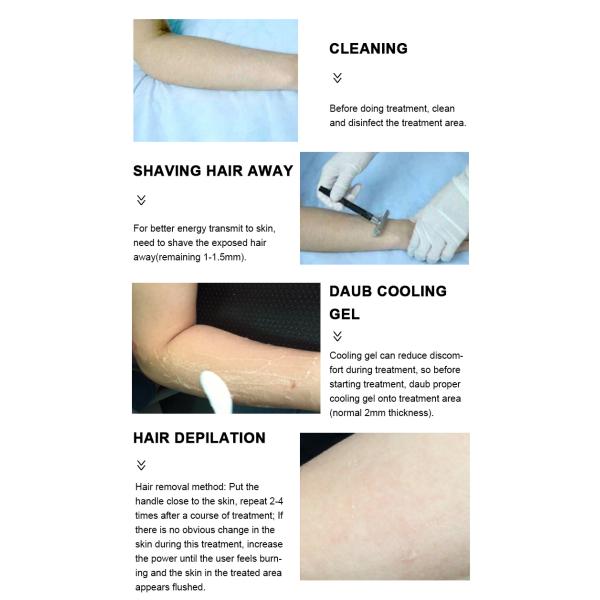 Portable 808nm Diode Laser Hair Removal Machine For Home hair removing laser machine lady hair removal machine