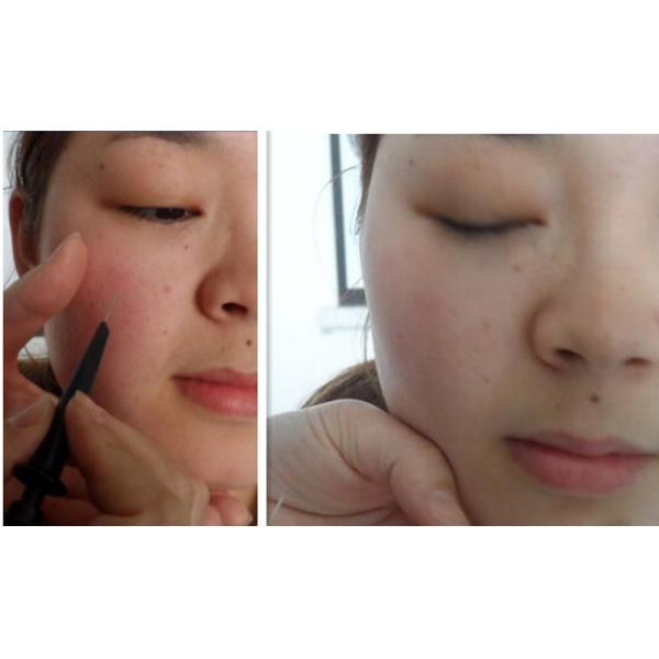 Promotions!!!spider vein removal machine Wholesale Ce Approval Rbs Vascular