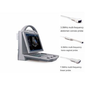 Portable Pregnancy Ultrasound Scanner with Abdominal Convex Transvaginal
