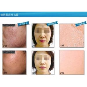 Good homemade natural Collagen Crystal Facial Masks