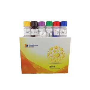 Quality Customized Anti-nuclear Antibody Mouse ELISA kit Pre - Coated with Mouse ANA ELISA kit for sale