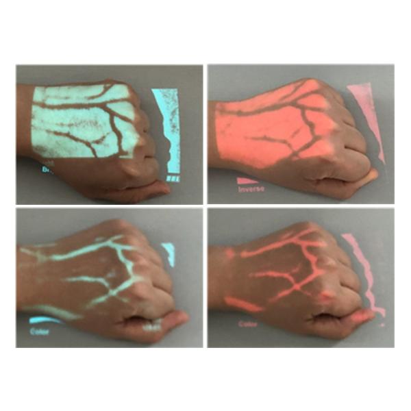 Mobile Trolley Type Infrared Vein Finder Vein Locator Device With Image