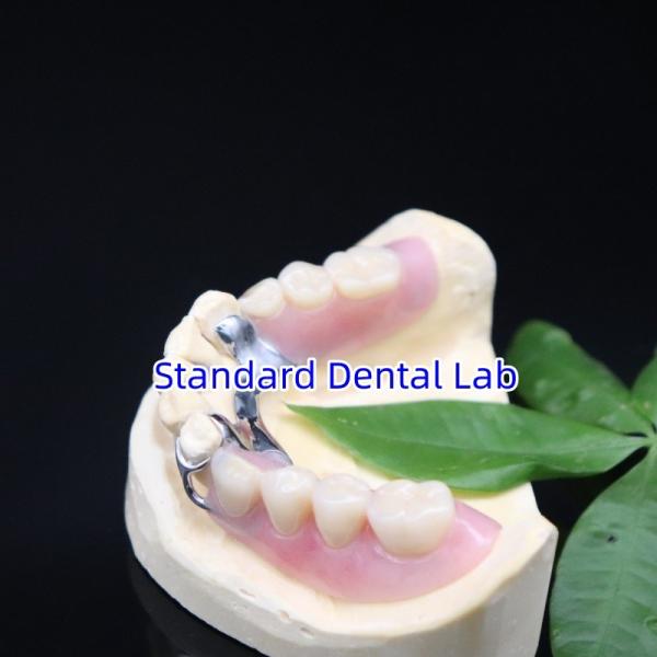 Buy Acrylic Metal Partial Denture Frameworks High Esthetics SDL dental lab at wholesale prices