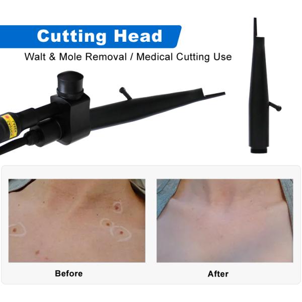 CO2 Fractional Laser Beauty Machine Medical Grade Vaginal Tightening Gynecology Aesthetic Vulva Rejuvenation