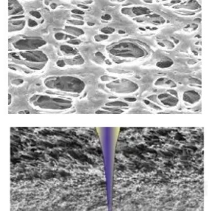 0.22μm to 5μm Pore Size PES Membrane for IV Infusion and Drip Chamber Filtration