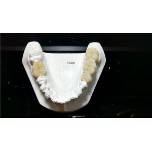 Ceramic Dental Crown,Zirconia Dental Crowns