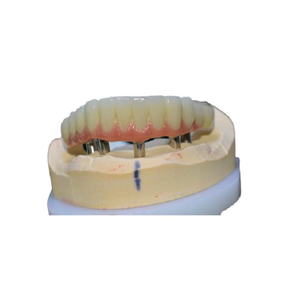 Buy Easy Cleaning Dental Implant Crown Comfortable No Foreign Body Sensation at wholesale prices