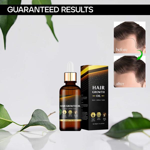 Private Labe Hair Growth Oil With Caffeine, Biotin For Stronger, Thicker, Longer