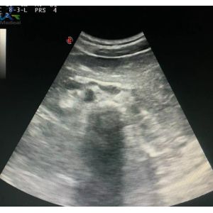 Quality Biosound CA541 Convex Ultrasound Transducer Medical Equipment Spare Parts for sale