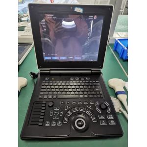 Windows7 Laptop Doppler Ultrasound Machine Imaging 12in With Dual Transducer