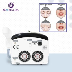 tattoo removal 1600mj 532nm NND YAG Q Switched Laser