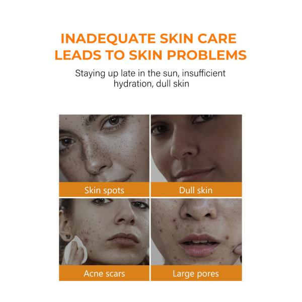 Private Label Face Toner Moisturizing Spray Deep Face Hydrating Quickly Absorb VC Whitening Skin Moisturizing Face Spray