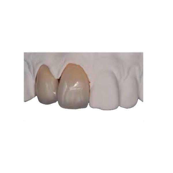 Buy Body Strength Thin Zirconia Crown Durable Natural Realistic Restoration at wholesale prices