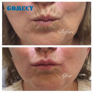 New arrival pulse electromagnetic for face beauty 3 handle ems body slimming rf