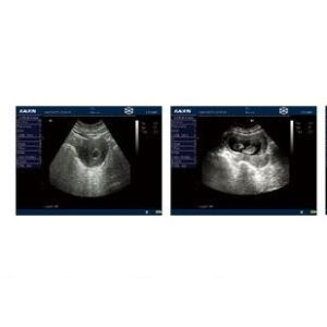 Hand Held Ultrasound Devics Portable Ultrasound Scanner with 10.4 Inch High